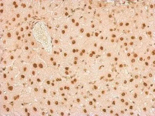 Immunohistochemistry U1A Antibody