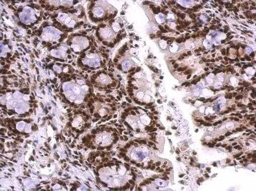 SNRPA antibody detects SNRPA protein at nucleus on mouse colon by immunohistochemical analysis. Sample: Paraffin-embedded mouse colon. SNRPA antibody (NBP2-53095) dilution: 1:500.Antigen Retrieval: Trilogy(TM) (EDTA based, pH 8.0) buffer, 15min 
