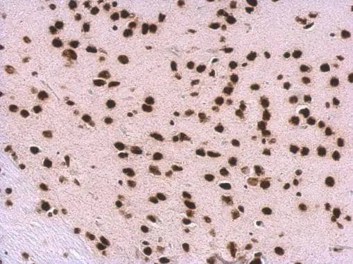 SNRPA antibody detects SNRPA protein at nucleus on mouse fore brain by immunohistochemical analysis. Sample: Paraffin-embedded mouse fore brain. SNRPA antibody (NBP2-53095) dilution: 1:500.Antigen Retrieval: Trilogy(TM) (EDTA based, pH 8.0) buffer, 15min 