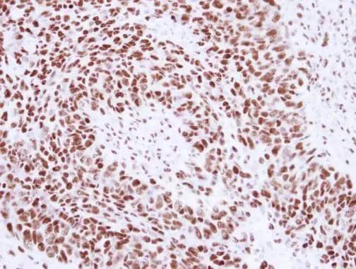 Immunohistochemistry U1A Antibody