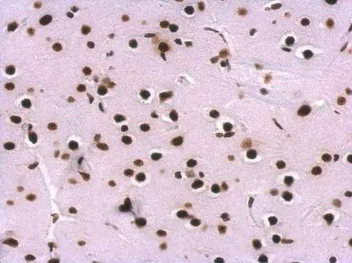 SNRPA antibody detects SNRPA protein at nucleus on rat fore brain by immunohistochemical analysis. Sample: Paraffin-embedded rat fore brain. SNRPA antibody (NBP2-53095) dilution: 1:500.Antigen Retrieval: Trilogy(TM) (EDTA based, pH 8.0) buffer, 15min 