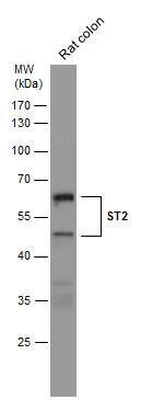 Rat tissue extract (50 ug) was separated by 10% SDS-PAGE, and the membrane was blotted with ST2 antibody [N1C1] (NBP2-53096) diluted at 1:500. 