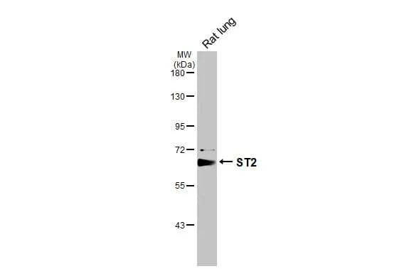 Rat tissue extract (50 ug) was separated by 7.5% SDS-PAGE, and the membrane was blotted with ST2 antibody [N1C1] (NBP2-53096) diluted at 1:1000. The HRP-conjugated anti-rabbit IgG antibody  was used to detect the primary antibody. 