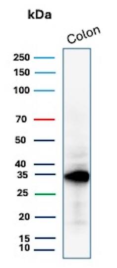 Western Blot Analysis of Colon tissue lysate using Calponin 1 Antibody (CNN1/1408R) - Azide and BSA Free.