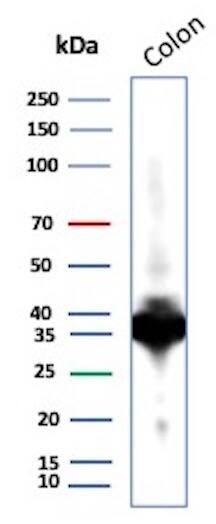 Western Blot Analysis of Colon tissue lysate using Calponin 1 Antibody (CNN1/1408R) - Azide and BSA Free.
