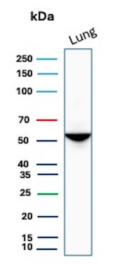 Western blot analysis of human Lung tissue lysate using Serpin A1/alpha 1-Antitrypsin Antibody (AAT/1379) - Azide and BSA Free.