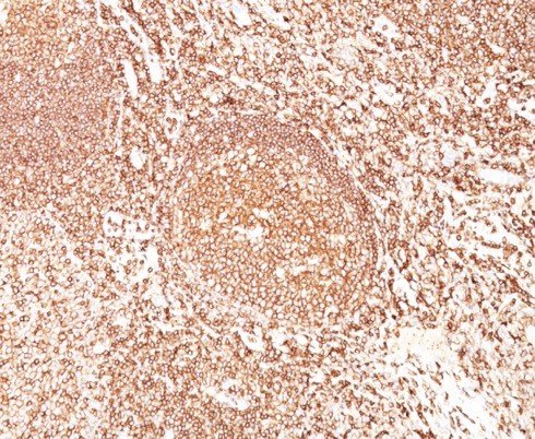 Formalin-fixed, paraffin-embedded human tonsil stained with B220/CD45R antibody (F10-89-4).