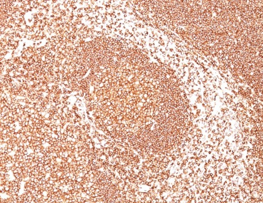 Formalin-fixed, paraffin-embedded human tonsil stained with B220/CD45R antibody (PTPRC/1461).