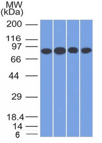 Western Blot Analysis of A) Jurkat (B) HeLa (C) MCF-7 & (D) K562 cell lysate using TfR (Transferrin R) Antibody (TFRC/1817) - Azide and BSA Free.