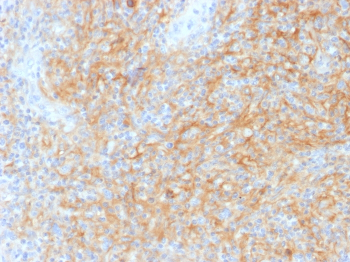 Formalin-fixed, paraffin-embedded human Hodgkin’s Lymphoma stained with CD40/TNFRSF5 antibody (C40/1605).