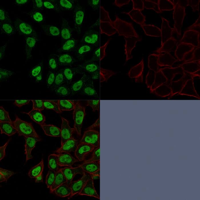 Confocal Immunofluorescence image of HeLa cells using TOP2A Antibody (TOP2A/1362) - Azide and BSA Free. Green (CF488) and Phalloidin (Red) is used to label the nuclei.