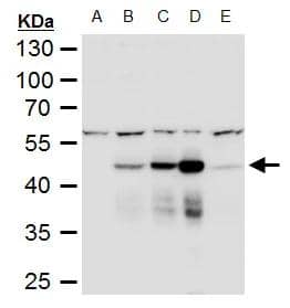 Western Blot Dengue Virus NS1 protein Antibody - BSA Free
