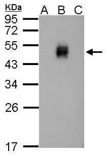 Western Blot Dengue Virus NS1 protein Antibody - BSA Free