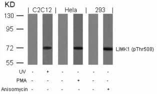 Western Blot: LIM Kinase 1/2 [p Thr508] Antibody - BSA Free [NBP2-54645] - Western blot analysis of lysed extracts from UV-treated C2C12, PMA-treated HeLa and anisomycin-treated 293 cells using LIM Kinase 1/2 (Phospho-Thr508).