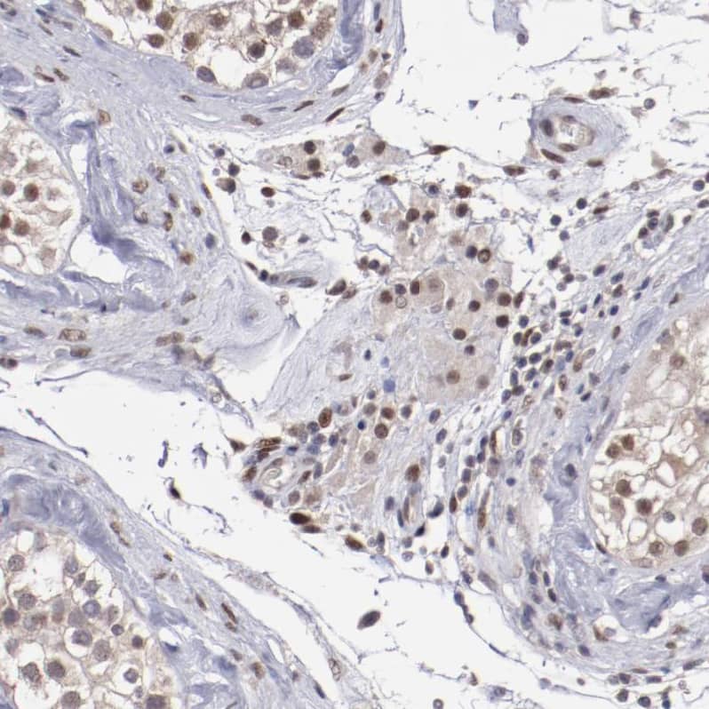 Staining of human testis shows moderate nuclear positivity in Leydig cells.