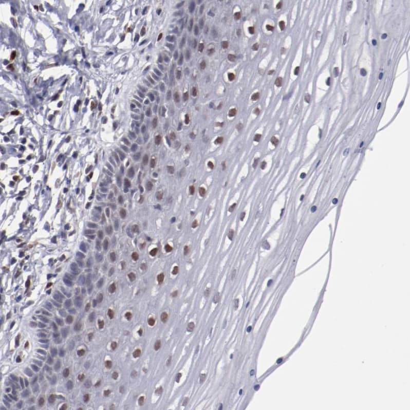 Staining of human cervix, uterine shows moderate nuclear positivity in squamous epithelial cells.
