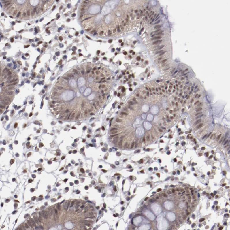 Staining of human colon shows moderate nuclear positivity in glandular cells.