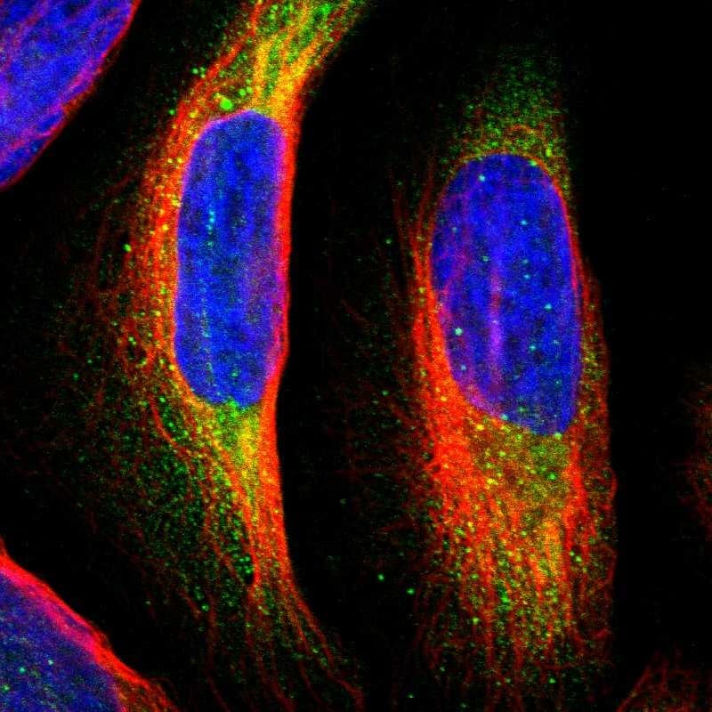Staining of human cell line U-2 OS shows localization to cytosol.