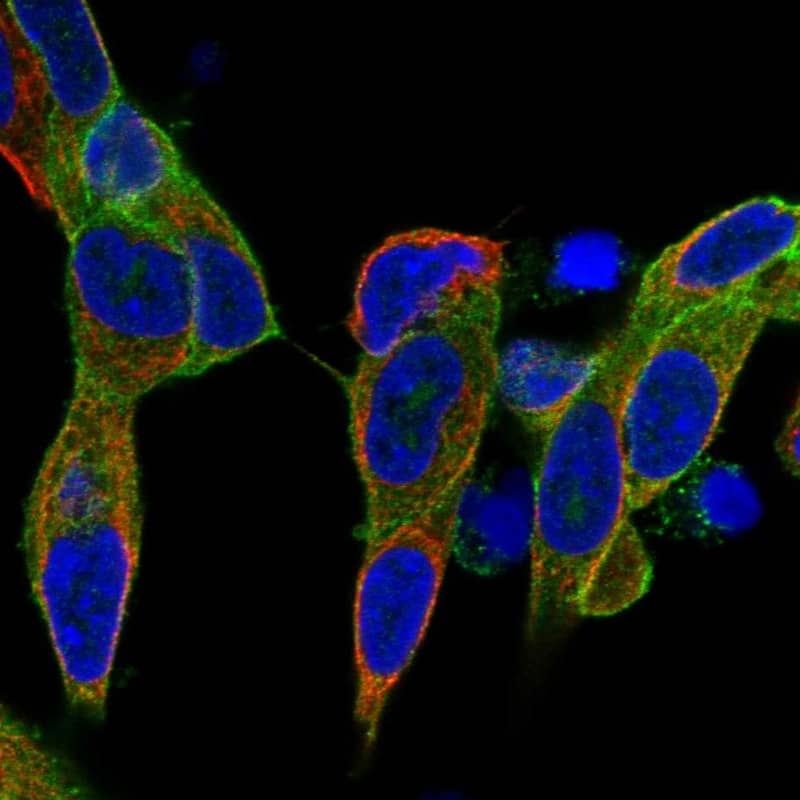 Staining of human cell line SH-SY5Y shows localization to plasma membrane.