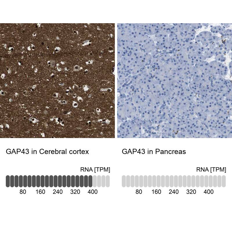 <b>Orthogonal Strategies Validation. </b>Analysis in human cerebral cortex and pancreas tissues.