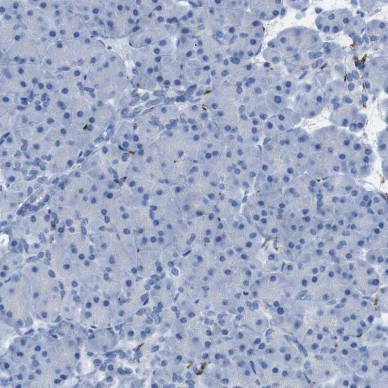 Staining of human pancreas shows low expression as expected.