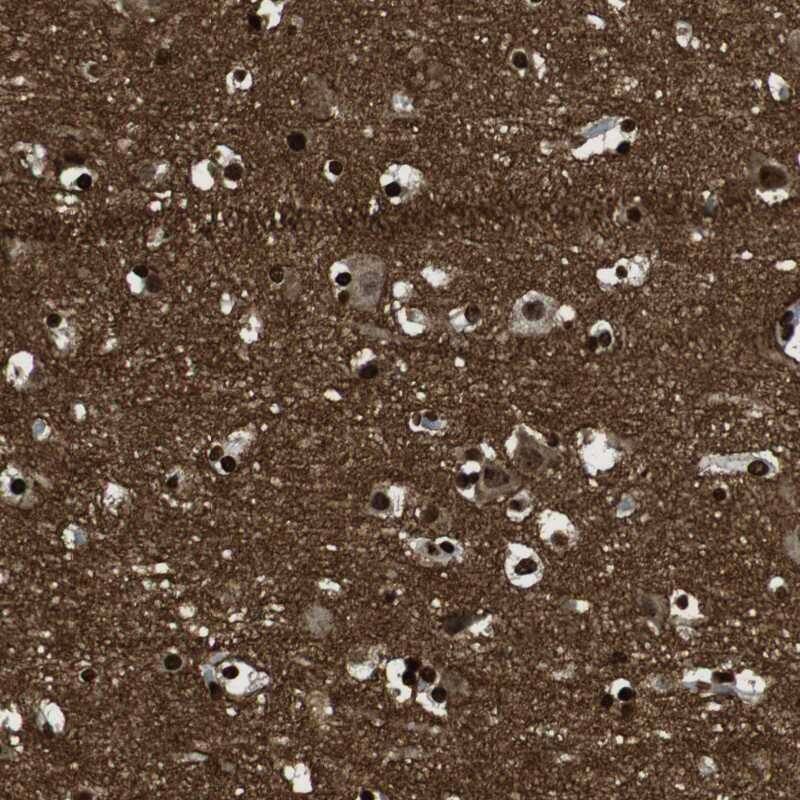 Staining of human cerebral cortex shows high expression.