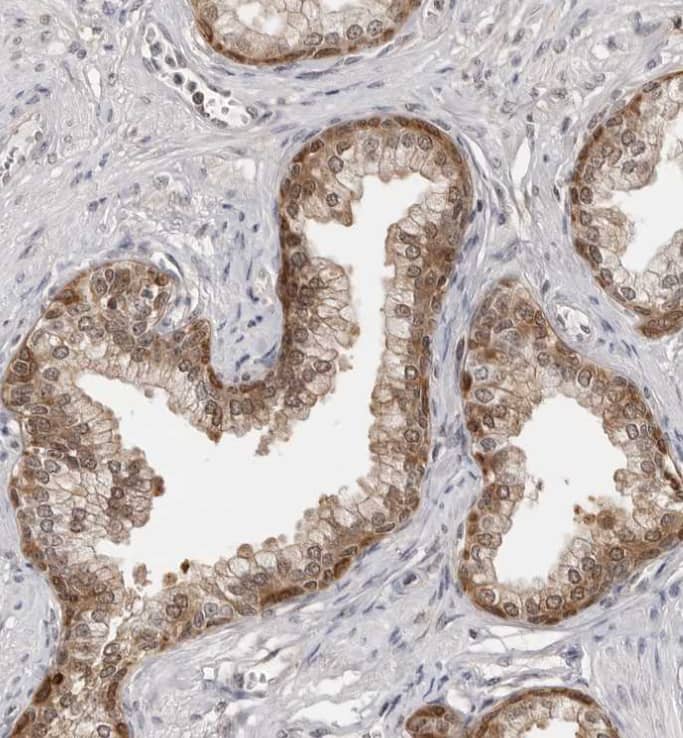  Staining of human prostate shows moderate cytoplasmic positivity in glandular cells.