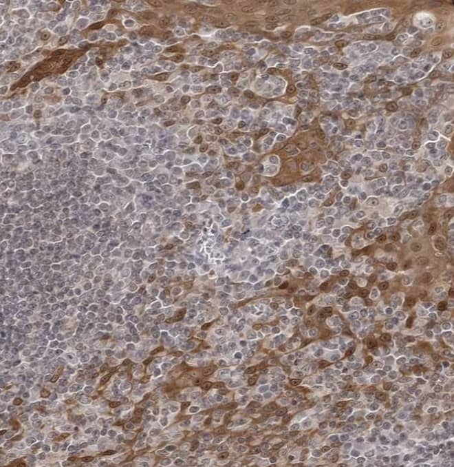 Staining of human tonsil shows strong cytoplasmic positivity in squamous epithelial cells.