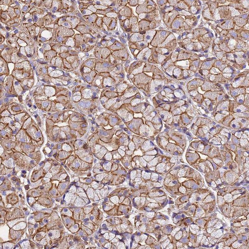 Staining of human stomach shows moderate membranous positivity.
