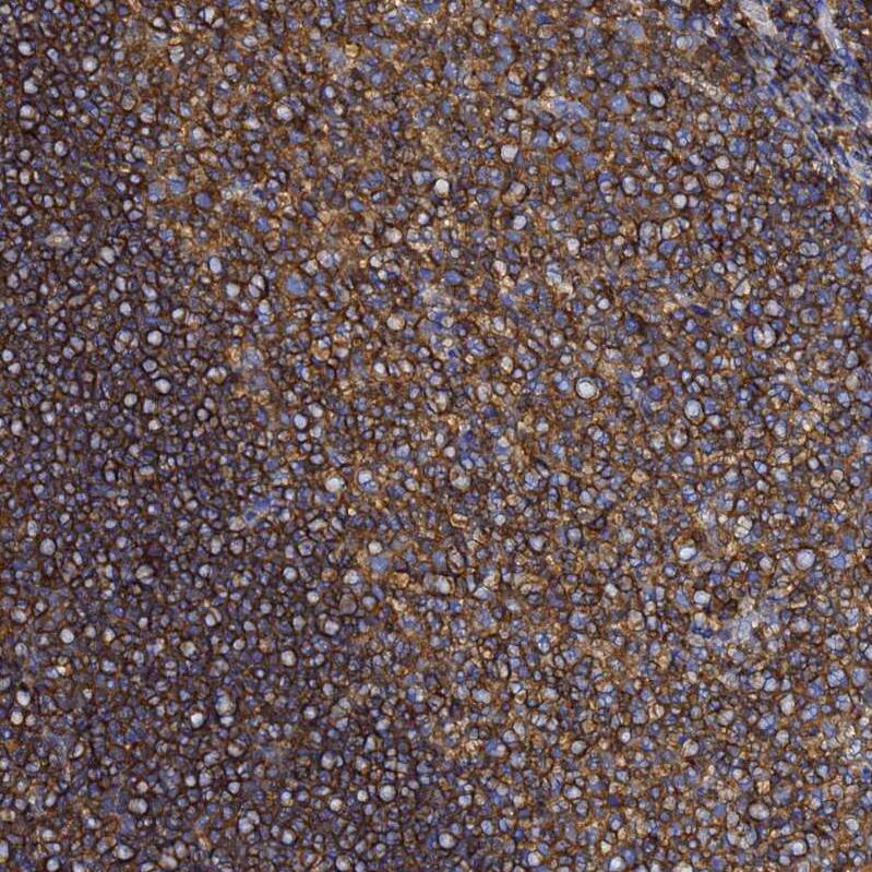 Staining of human tonsil shows strong positivity in lymphoid cells.