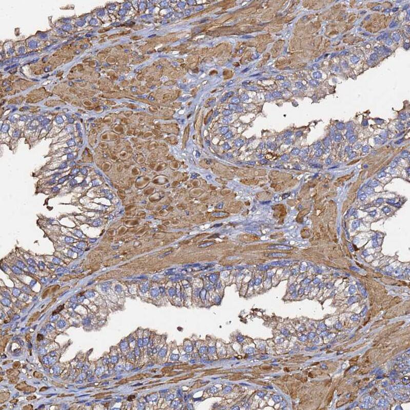Staining of human prostate shows moderate positivity in smooth muscle cells.