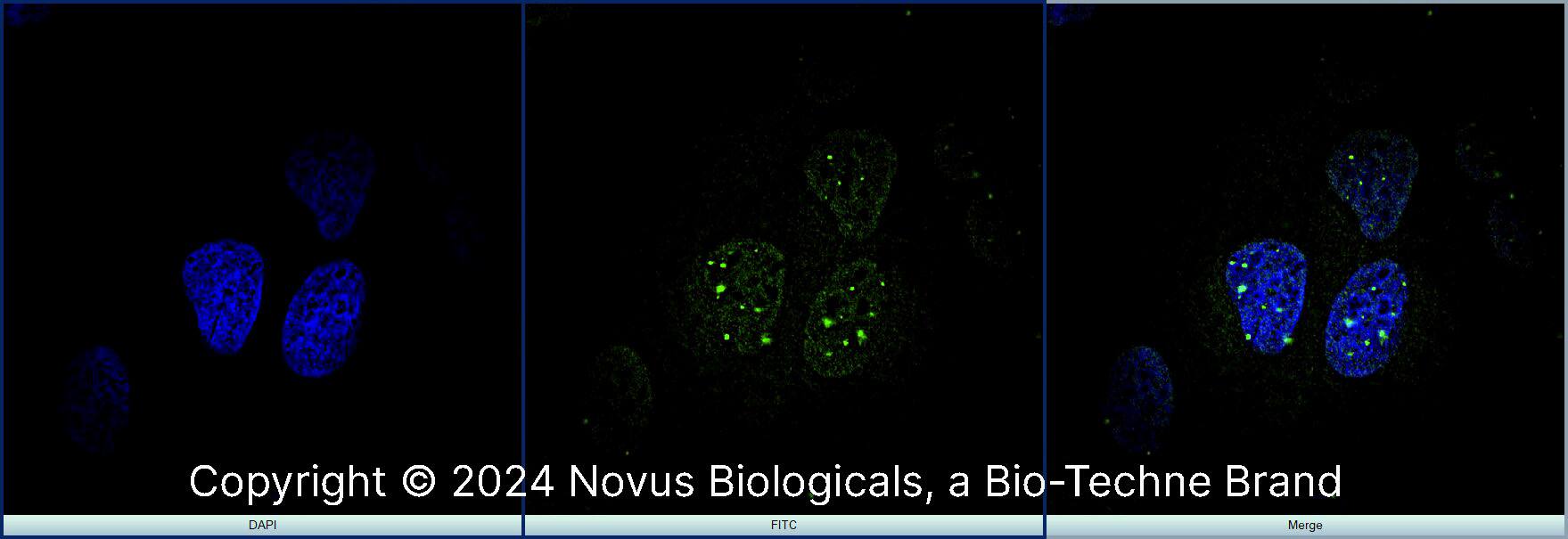 53BP1 (1285C) was detected in immersion fixed U-2 OS human osteosarcoma cell line using Rabbit anti-53BP1 (1285C) Protein G Purified Recombinant Monoclonal Antibody conjugated to Alexa Fluor® 488 (Catalog # NBP2-54753AF488) (green) at 5 µg/mL overnight at 4C. Cells were counterstained with DAPI (blue). Cells were imaged using a 100X objective and digitally deconvolved. 