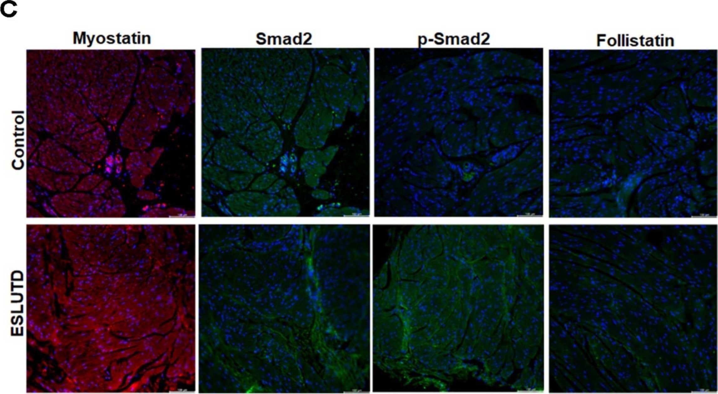 Differences in muscle-to-collagen ratio and Smad pathway proteins in control and ESLUTD bladder. (A) Masson’s trichrome staining in control and ESLUTD bladder detrusor muscle with smooth muscle tissue (red) and connective tissue (blue). (B) Quantification of muscle-to-collagen ratio in control (n = 4) and ESLUTD (n = 4) smooth muscle tissue, normalized to control taken as 100%. Muscle-to-collagen ratio was significantly lower in ESLUTD compared to control bladder. Statistics with unpaired t-test, ** p ≤ 0.01. (C) Antibody staining for myostatin (red) and its signaling pathway proteins Smad 2 (green), p-Smad 2 (green) and follistatin (green) with cell nuclei in blue. Scale bar, 100 μm. Image collected and cropped by CiteAb from the following open publication (//pubmed.ncbi.nlm.nih.gov/36901894), licensed under a CC-BY license. Not internally tested by Novus Biologicals.