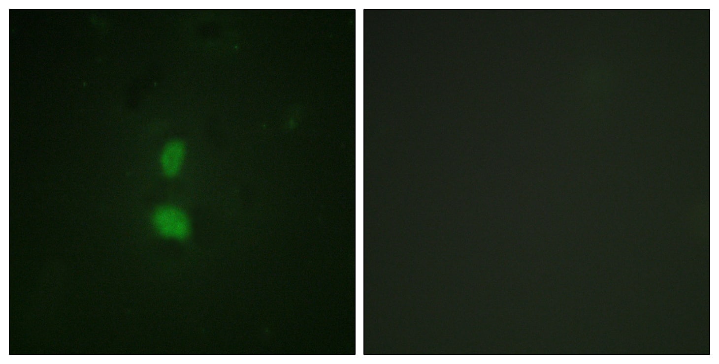 <b>Biological Strategies Validation. </b>Immunocytochemistry/ Immunofluorescence: Snail [p Ser246] Antibody - BSA Free [NBP2-54776] - Immunofluorescence staining of methanol-fixed HuvEc cells using Snail (Phospho-Ser246) Antibody. 