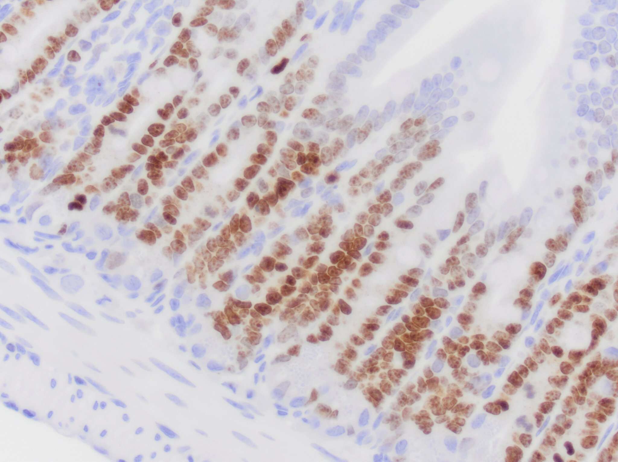 Immunohistochemistry-Paraffin: Ki67/MKI67 Antibody (1297A) [NBP2-54791] - Ki67/MKI67 immunoreactivity in mouse small intestine. NBP2-54791 was diluted to 0.5ug/mL in Antibody Diluent and was left on sections for 1h at room temperature. Secondary was Horse Anti-Rabbit HRP. Image from verified customer review.