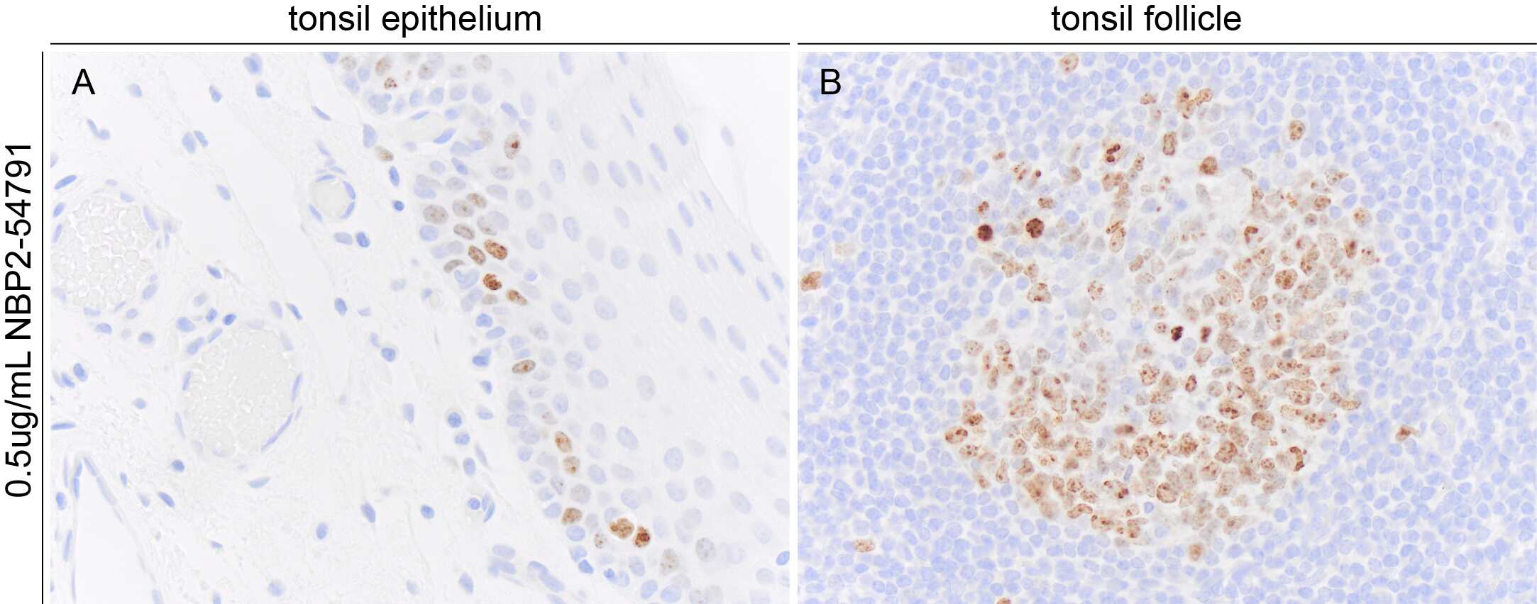 Immunohistochemistry-Paraffin: Rabbit Monoclonal Ki67/MKI67 Antibody (1297A) [NBP2-54791] - Ki67 immunoreactivity in FFPE sections of human tonsil. NBP2-54791 was used at 500ng per mL and was left on tissue sections for 1hr at room temperature. Image from a verified customer review.
