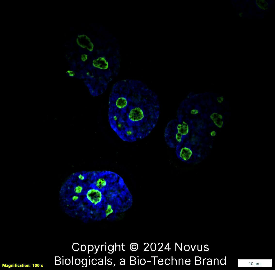 Ki67/MKI67 (1297A) was detected in immersion fixed A431 human skin carcinoma cell line using Rabbit anti-Ki67/MKI67 (1297A) Protein G Purified Recombinant Monoclonal Antibody conjugated to Alexa Fluor® 488 (Catalog # NBP2-54791AF488) (green) at 2 µg/mL overnight at 4C. Cells were counterstained with DAPI (blue). Cells were imaged using a 100X objective and digitally deconvolved.