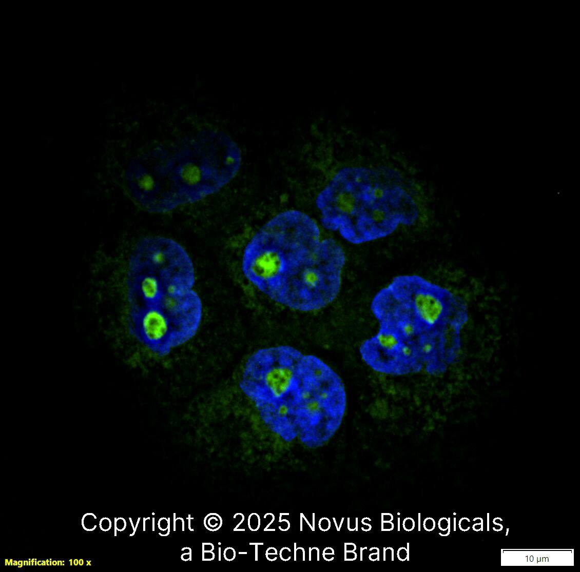 Ki67/MKI67 (1297A) was detected in immersion fixed A431 human skin carcinoma cell line using Rabbit anti-Ki67/MKI67 (1297A) Protein G Purified Monoclonal Antibody conjugated to FITC (Catalog # NBP2-54791F) (green) at 5 µg/mL overnight at 4C. Cells were counterstained with DAPI (blue). Cells were imaged using a 100X objective and digitally deconvolved.