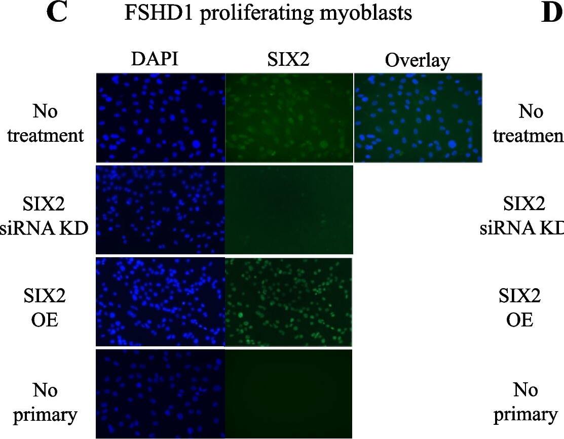 Immunocytochemistry/ Immunofluorescence SIX2 Antibody - BSA Free