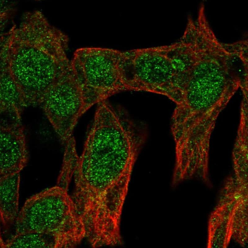 Immunocytochemistry/ Immunofluorescence GCNF/NR6A1 Antibody - BSA Free
