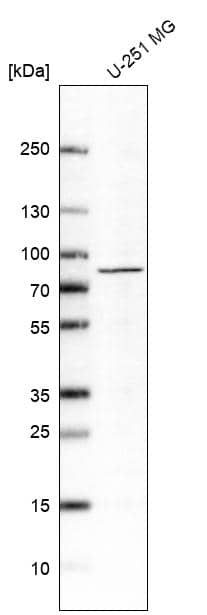 Analysis in human cell line U-251 MG.
