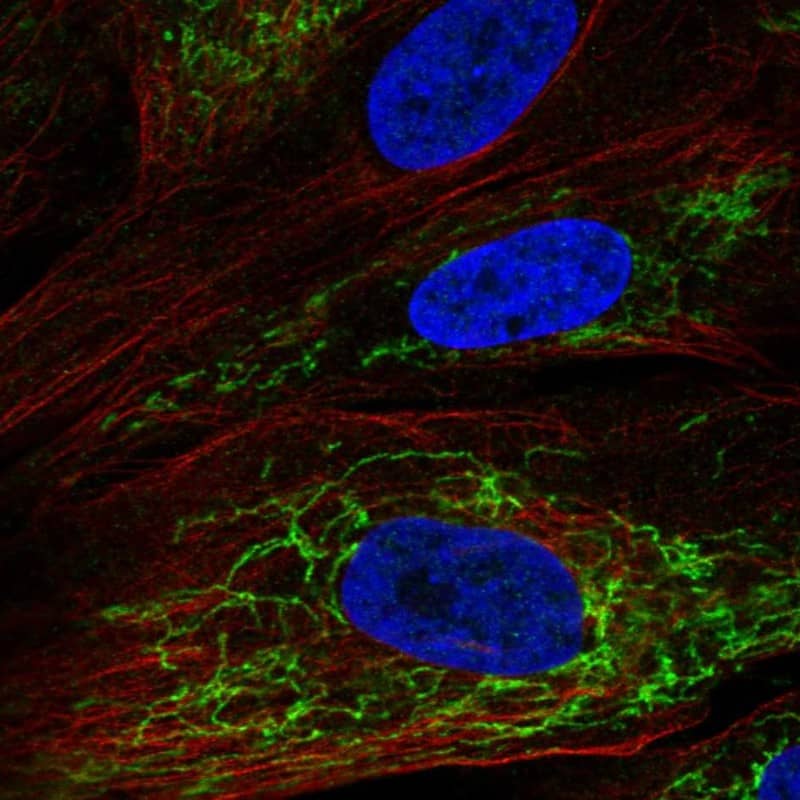 Staining of human cell line BJ shows localization to mitochondria.