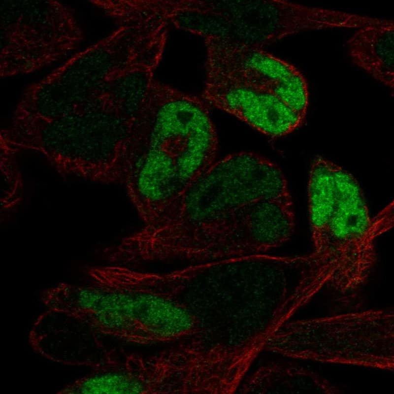 Staining of human cell line RH-30 shows localization to nucleoplasm.