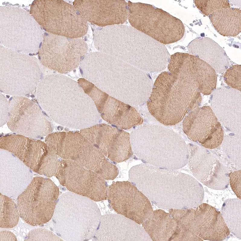 Immunohistochemistry-Paraffin Aminopeptidase B/RNPEP Antibody - BSA Free