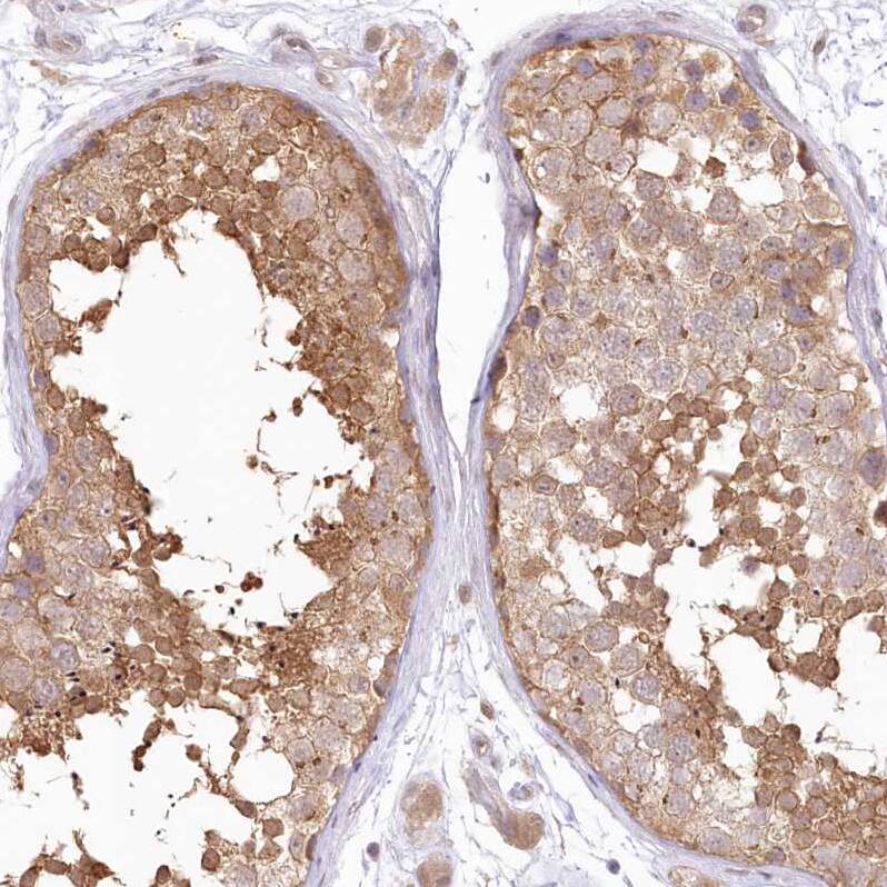 Staining of human testis shows moderate cytoplasmic positivity in cells in seminiferous ducts.