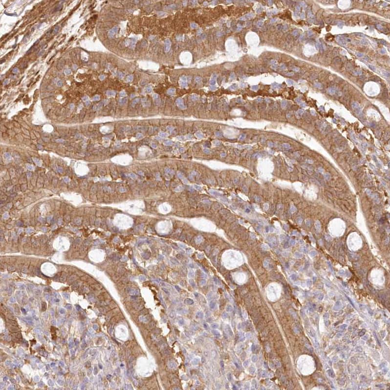 Staining of human duodenum shows moderate cytoplasmic and membranous positivity in glandular cells.