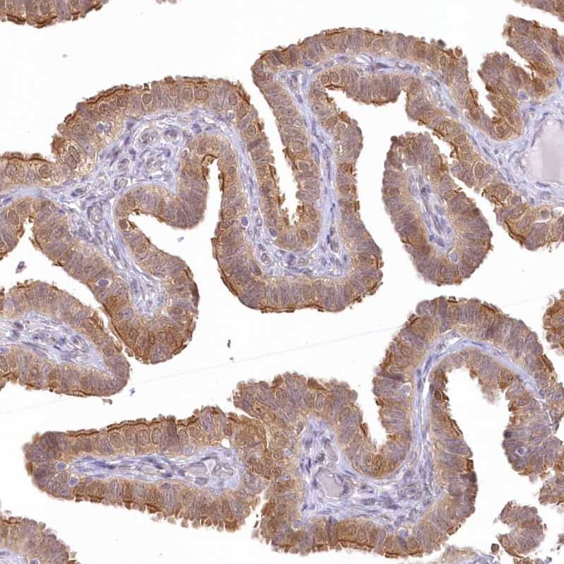 Staining of human fallopian tube shows moderate cytoplasmic positivity in glandular cells.