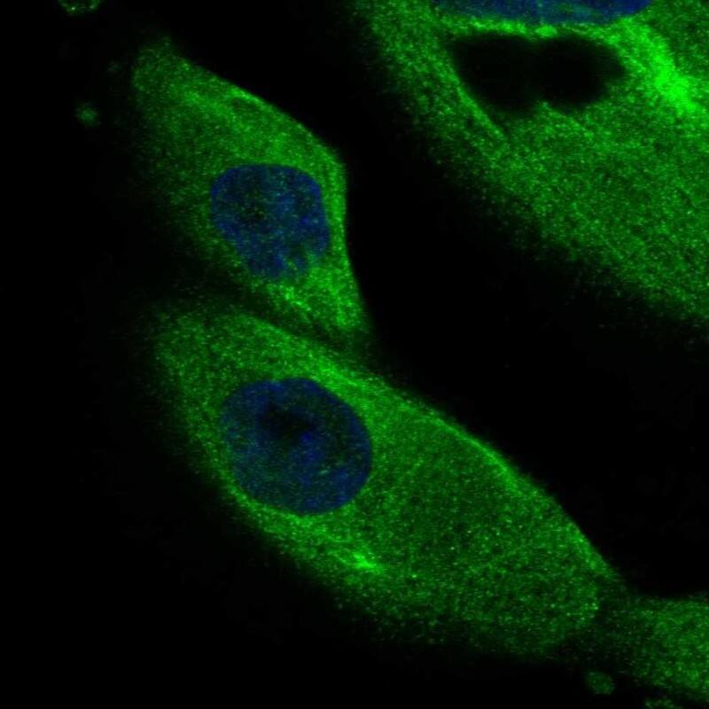 Staining of human cell line RPTEC TERT1 shows localization to cytosol, microtubule organizing center, microtubules & mitotic spindle.