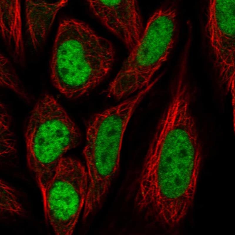 <b>Independent Antibodies Validation. </b>Staining of human cell line SiHa shows localization to nucleoplasm.