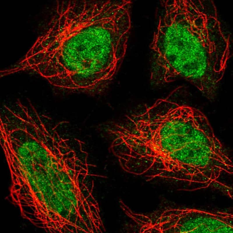 Staining of human cell line SiHa shows localization to nucleoplasm.